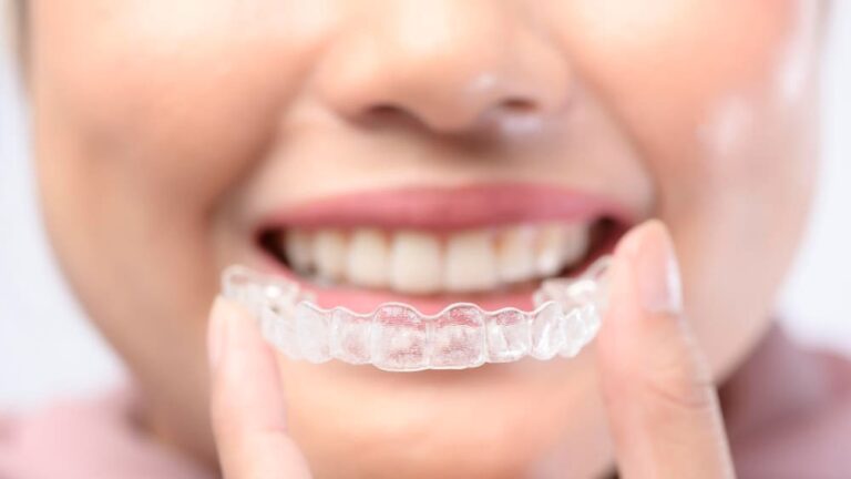 Po jakim czasie widać efekty leczenia Invisalign