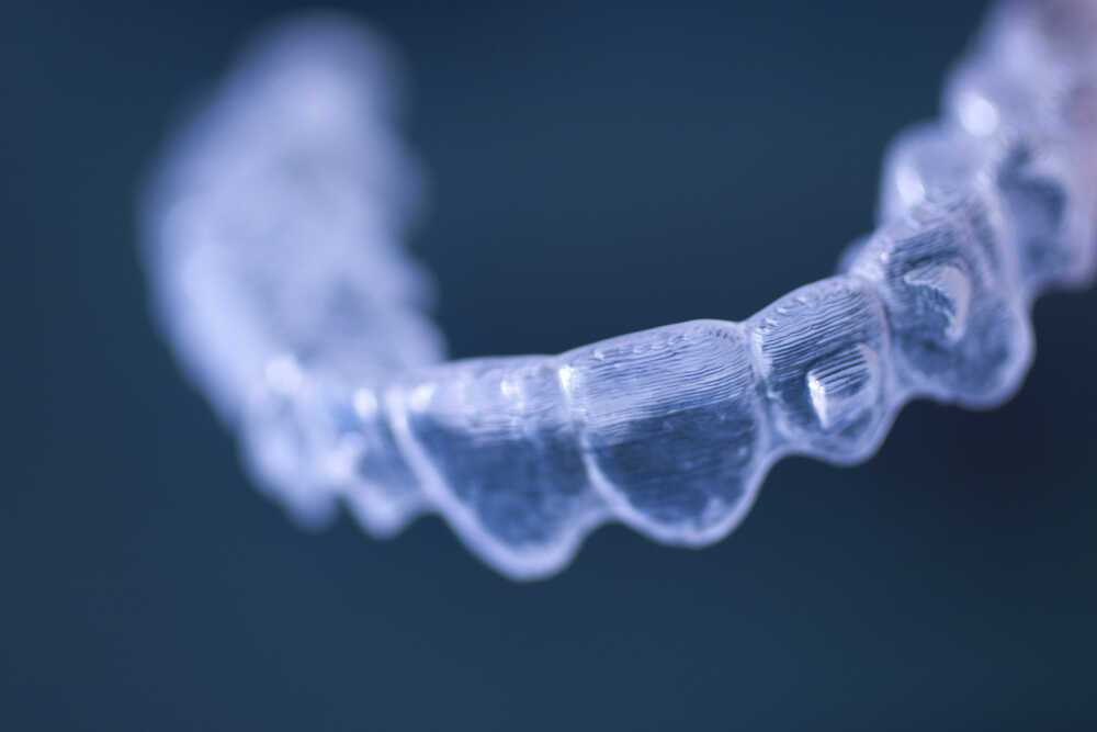 Attachmenty na zębach - czym są i do czego służą?